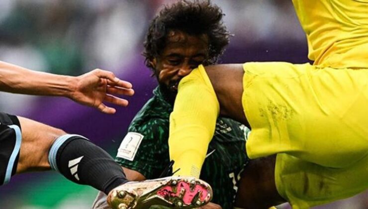 Arjantin maçında yüzü adeta dağılmıştı! Suudi futbolcu hastaneden son halini paylaştı