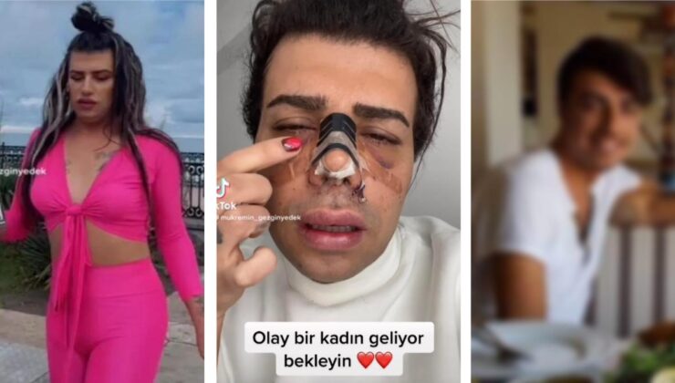 Hamilelik Senaryosuyla Gündemi Meşgul Eden TikTok Fenomeni Mükremin Gezgin’in Eski Hali Ortaya Çıktı