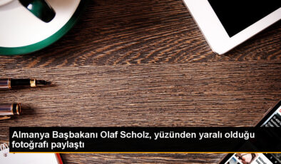 Almanya Başbakanı Scholz, düşmesinin akabinde yaralı yüzünü paylaştı