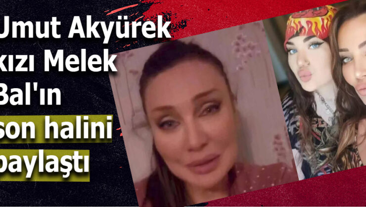 MELEK BAL’IN TEDAVİ SÜRECİ DEVAM EDİYOR: AİLE İÇİNDE UMUT YEŞERİYOR