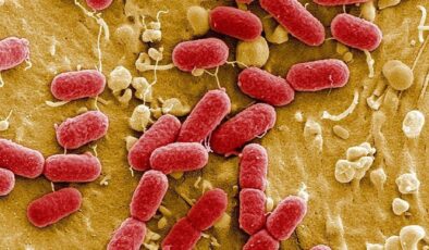 Florida’da et yiyen bakteri alarmı