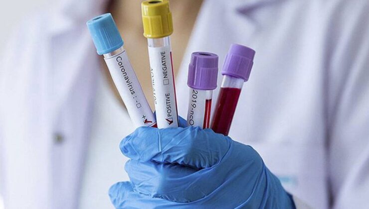 TTB’DEN SALGIN UYARISI: “BU YIL GRİP DAHA AĞIR GEÇECEK”